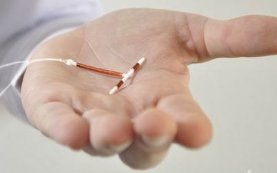 Paragard IUD Removal Allegedly Causing Injuries