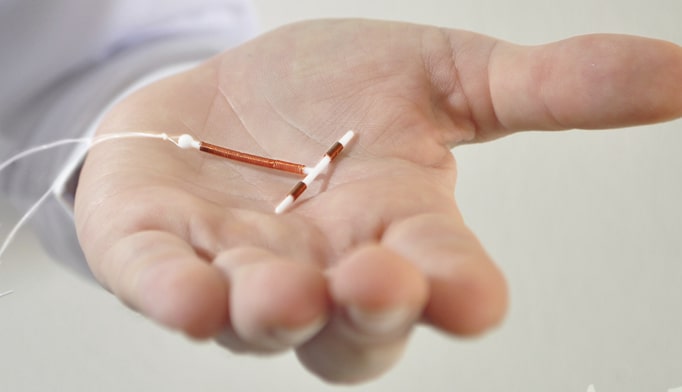 Paragard IUD Removal Allegedly Causing Injuries